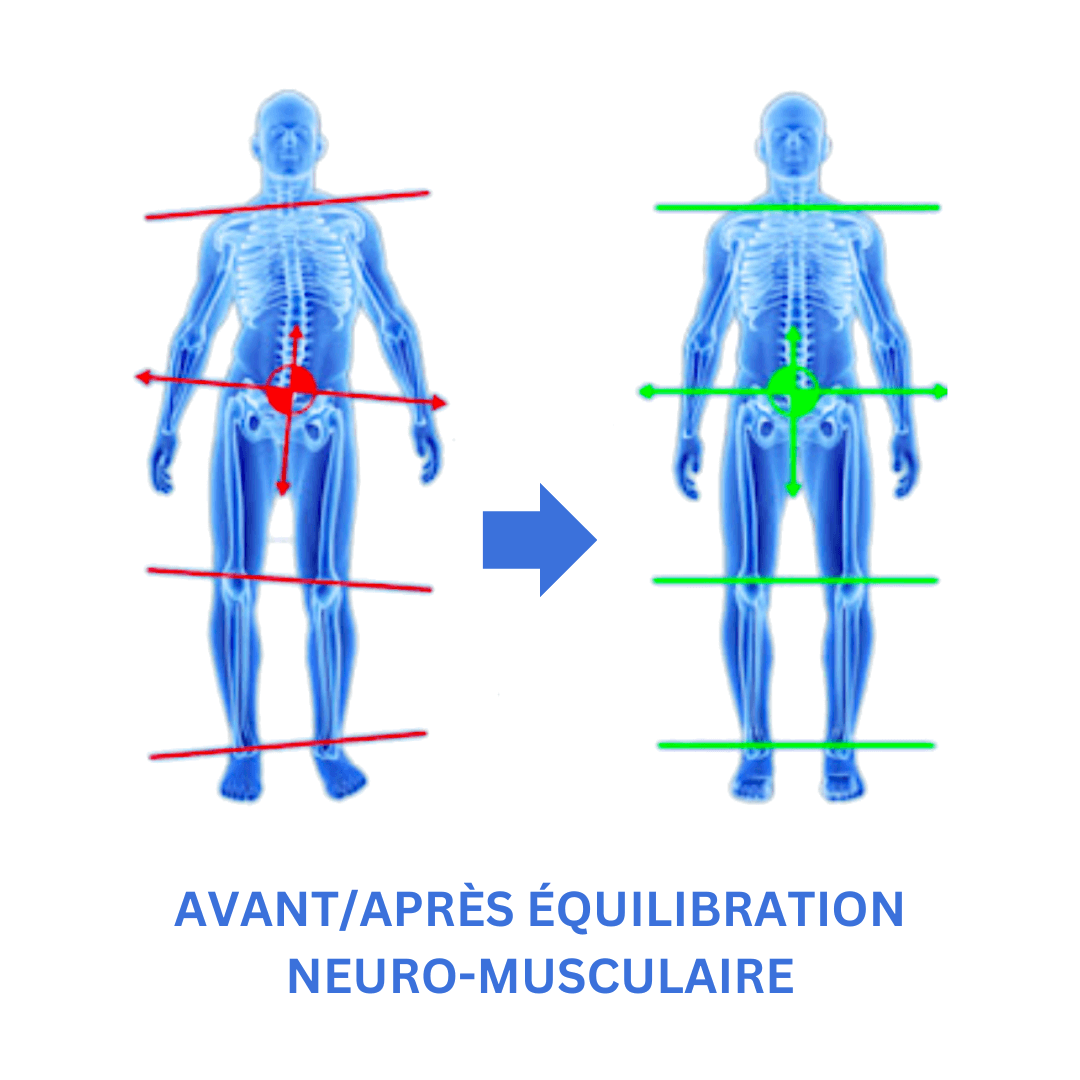 Avant/Après équilibration neuro-musculaire